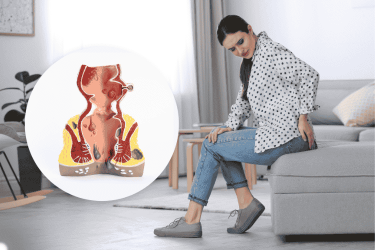 Fistula treatment | Dr Amol Gosavi