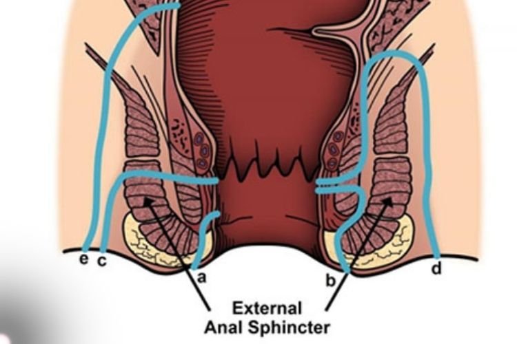 Advanced Laser Proctologist | Dr.Amol Gosavi | Thane