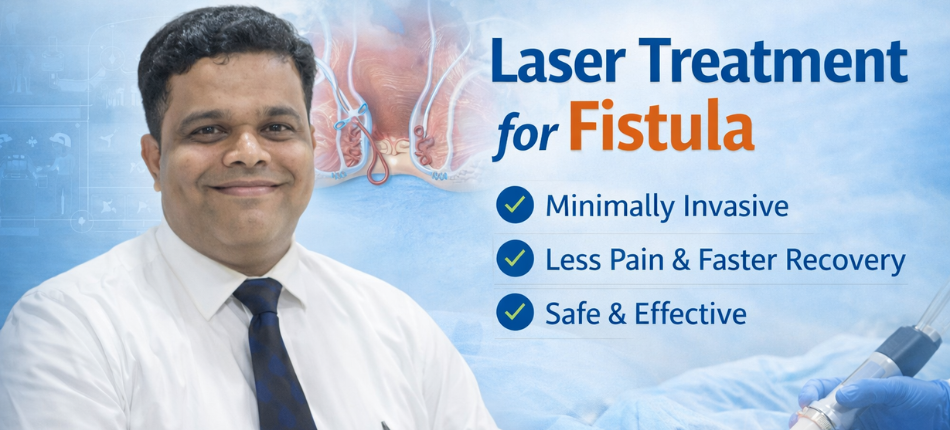 Laser Treatment for Fistula