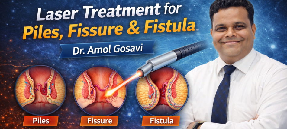 create an image of Laser Treatment for Piles, Fissure & Fistula : Dr. Amol Gosavi (950*430px)