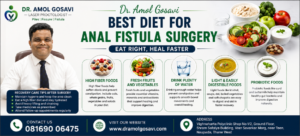 Anal Fistula Treatment in Thane | Dr. Amol Gosavi