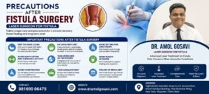 Laser Surgeon for Fistula| Dr. Amol Gosavi