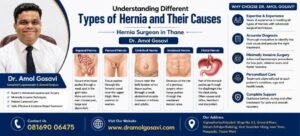 Hernia Surgeon in Thane | Dr. Amol Gosavi