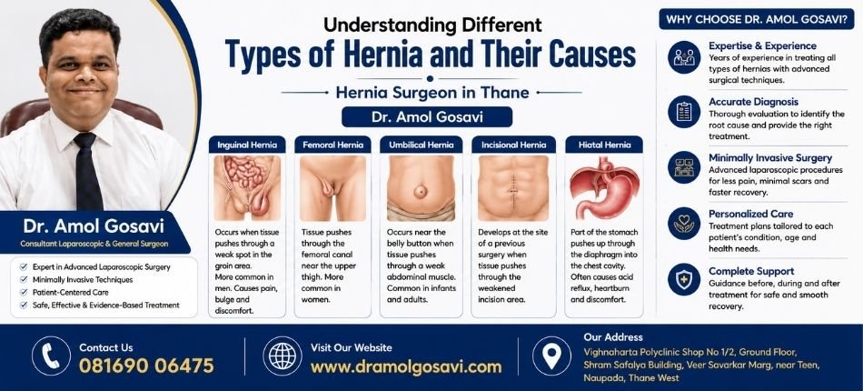Hernia Surgeon in Thane | Dr. Amol Gosavi