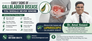 Laparoscopic gallbladder surgery | Dr. Amol Gosavi