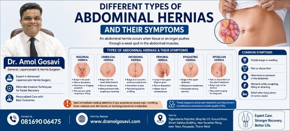 Types of Abdominal Hernias and Their Symptoms | Dr. Amol Gosavi