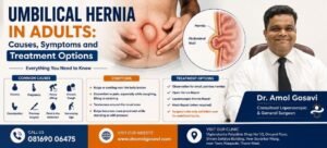 Umbilical Hernia in Adults | Dr. Amol Gosavi