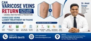 Varicose Veins Laser Treatment in Thane | Dr. Amol Gosavi