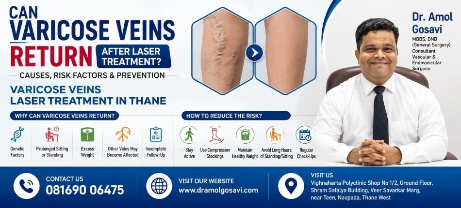Varicose Veins Laser Treatment in Thane | Dr. Amol Gosavi