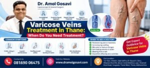 Laser Proctologist in Thane | Dr. Amol Gosavi