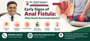 Anal Fistula Symptoms in Thane | Dr. Amol Gosavi