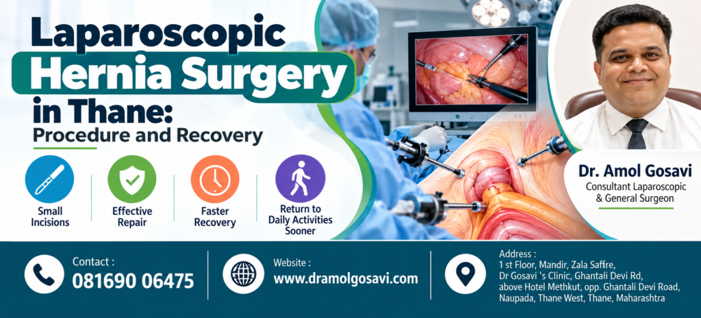 Laparoscopic Hernia Surgery in Thane | Dr. Amol Gosavi