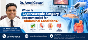 Laparoscopic Abdominal Surgery in Thane | Dr. Amol GOsavi