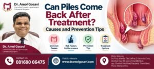 Piles Recurrence After Treatment | Dr. Amol Gosavi